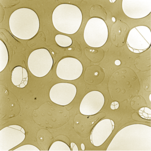 Astigmatism Correction